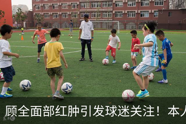 顾全面部红肿引发球迷关注！本人解释是多年皮肤问题并非外伤伤疤